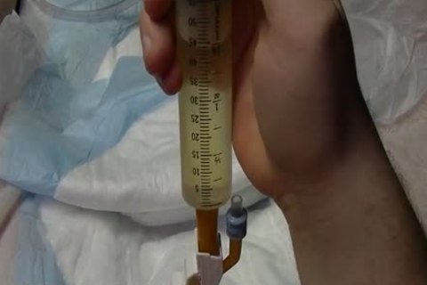 I insert A 24 French Catheter In Me. I Take In 500 ML Of Water In My Bladder. whilst My Bladder Is To The Bursting Point Play With Myself To The Point I cum whilst Having A Full Bladder. At The End I Drain My Bladder Then Remove The Catheter.